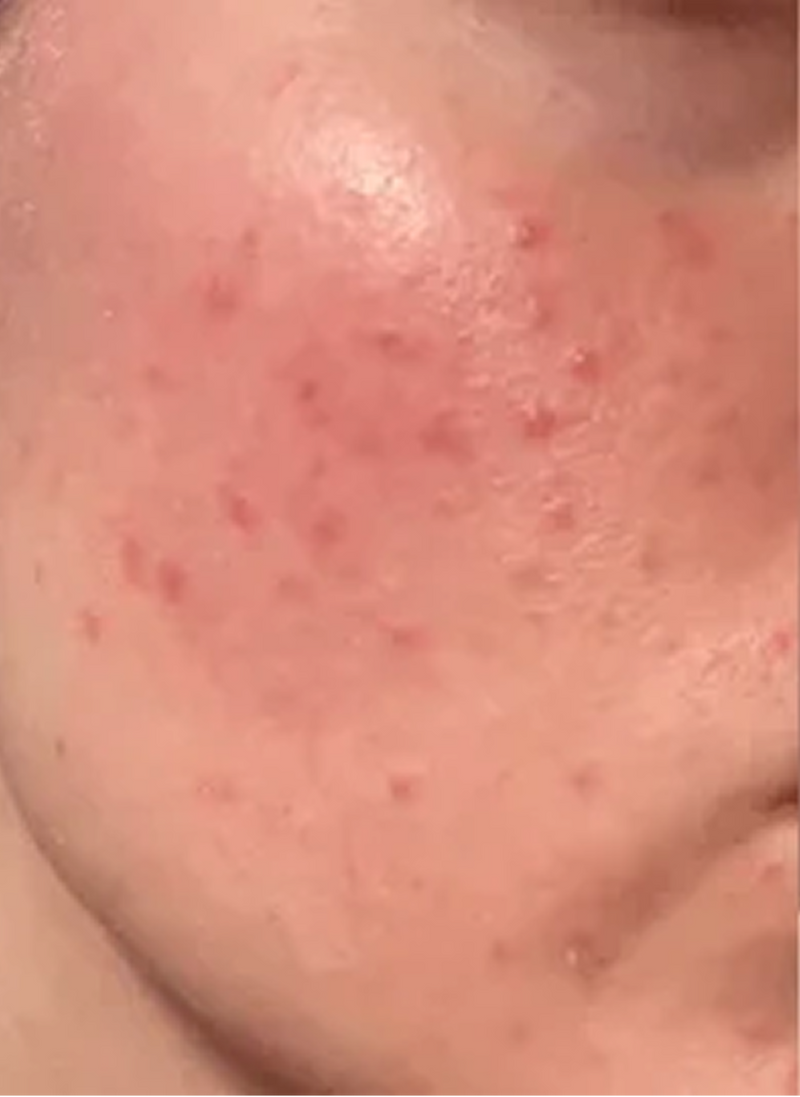 Before Image